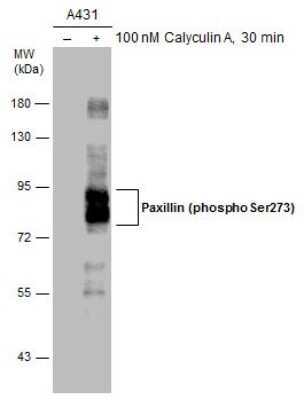 Western Blot: Paxillin [p Ser273] Antibody [NBP3-13099]